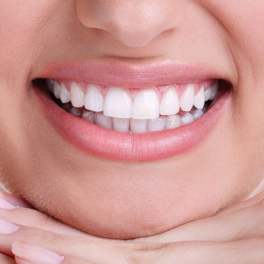 cosmetic dentist in Hutchinson teeth whitening